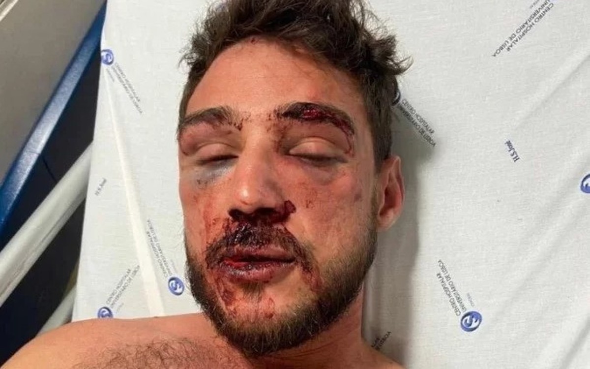 Casal Gay Brasileiro Denuncia Espancamento Em Bar De Portugal Quebraram Meu Nariz E Me Afogaram