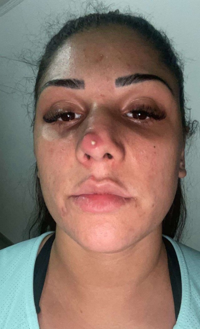Mulher que agrediu casal gay em padaria é acusada de extorsão ameaça e