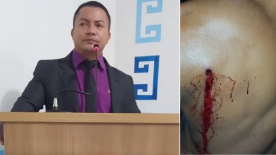Vereador do Pará suspeito de atirar contra assentado tem prisão mantida após audiência de custódia