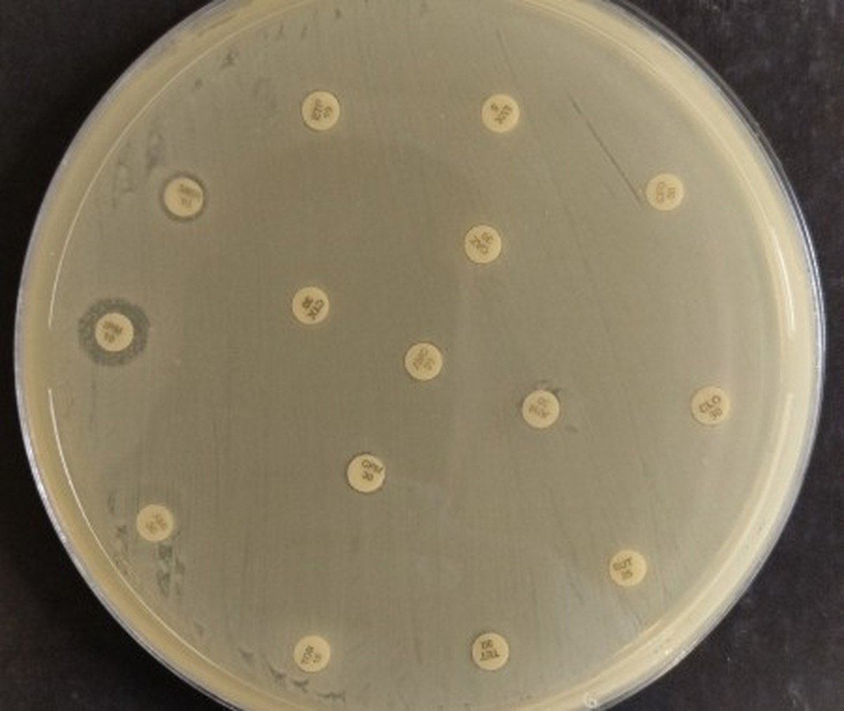 Bactéria multirresistente que representa risco global de saúde é ...