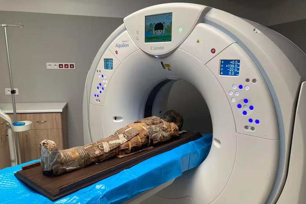 O exame radiológico sistemático permitiu explorar o interior do corpo da múmia — Foto: La Nacion