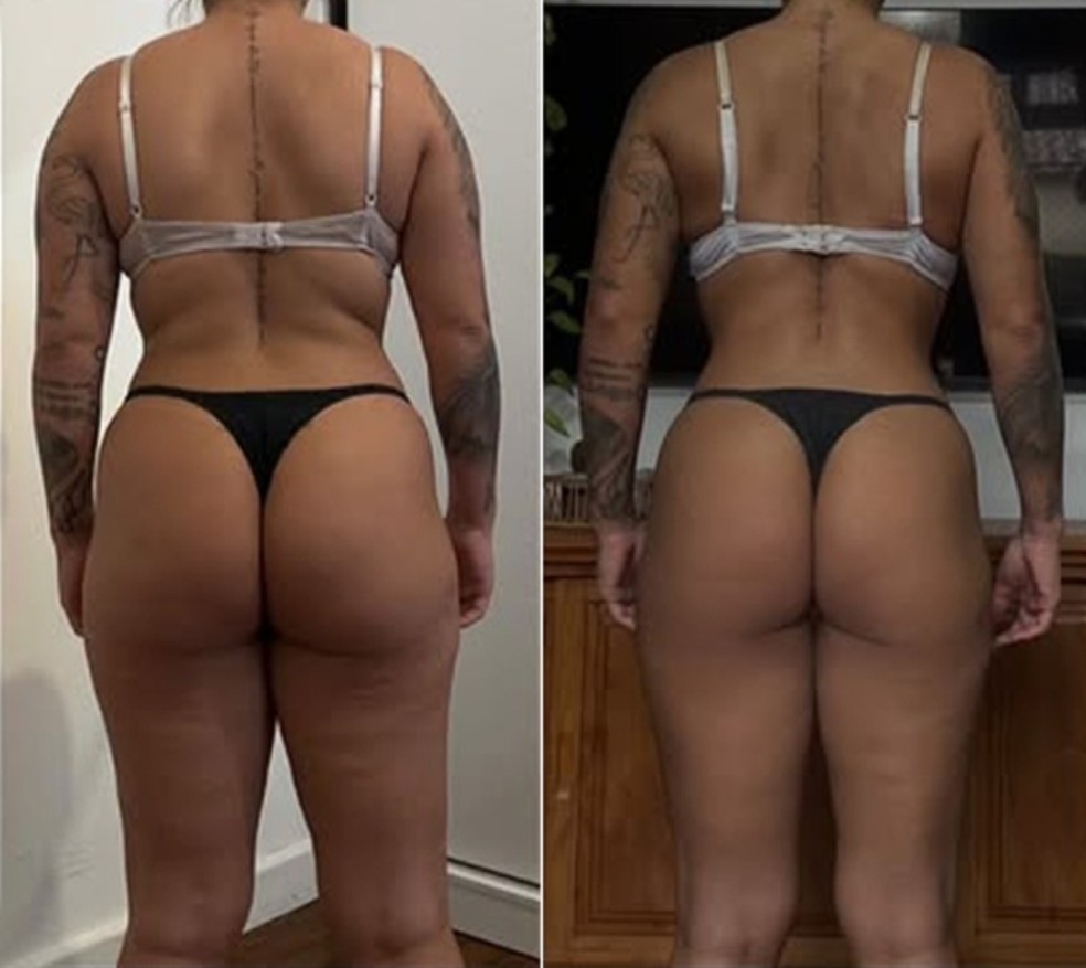 Petra Mattar mostrou antes e depois do emagrecimento — Foto: Reprodução Instagram
