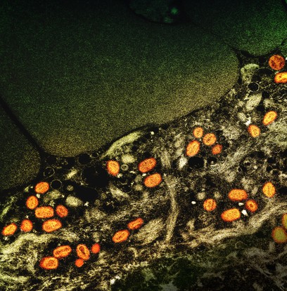 Micrografia eletrônica de transmissão colorida de partículas do vírus da varíola dos macacos (laranja) encontradas dentro de uma célula infectada (marrom), cultivadas em laboratório. NIAID