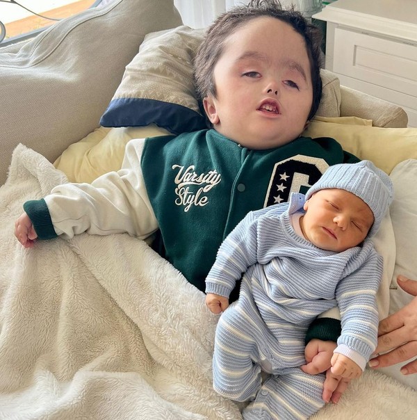Entenda condição rara que acomete o pequeno Noah, neto do apresentador ...