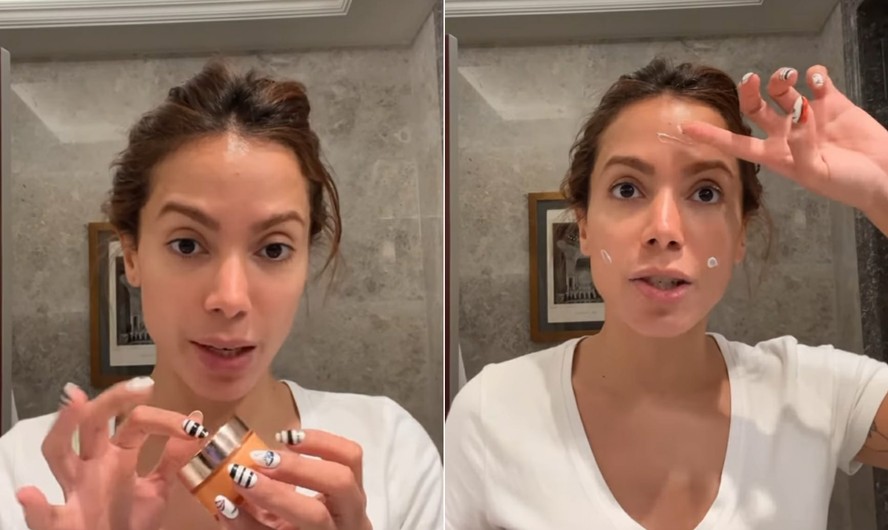 Anitta passa creme feito com seu sangue no rosto; procedimento é utilizado para rejuvenescer a pele