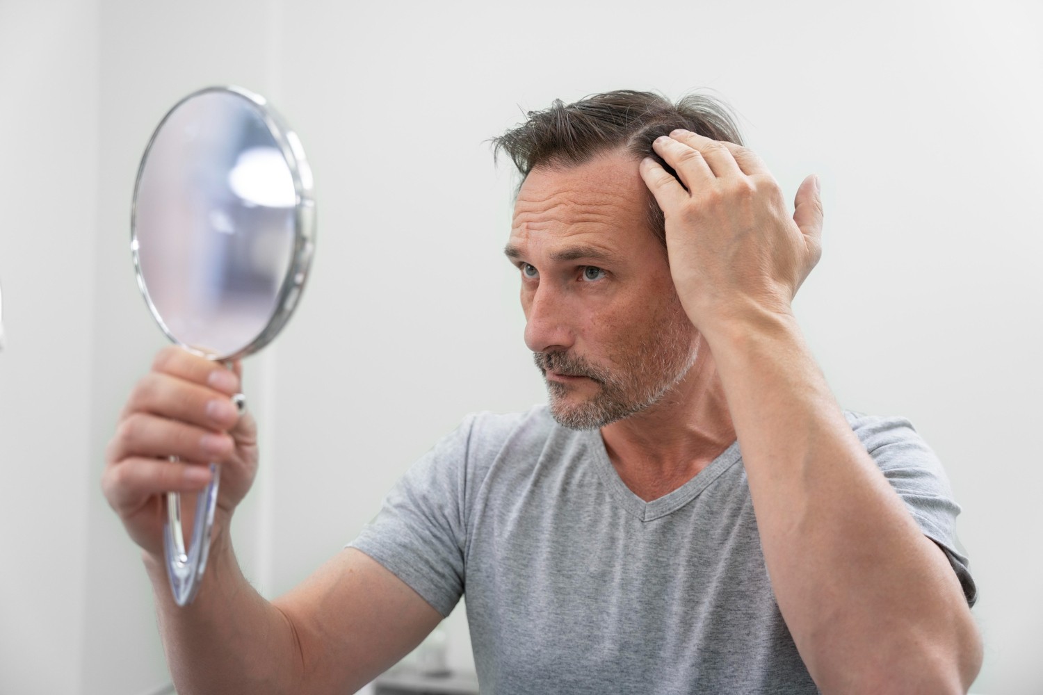 Tratamentos ampliam alternativas para calvície masculina