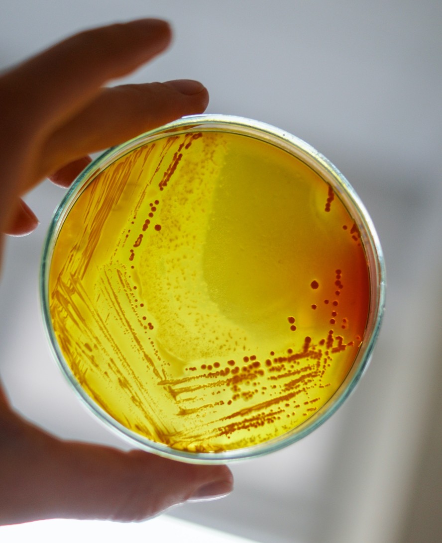 Cultura de laboratório da bactéria Staphylococcus aureus