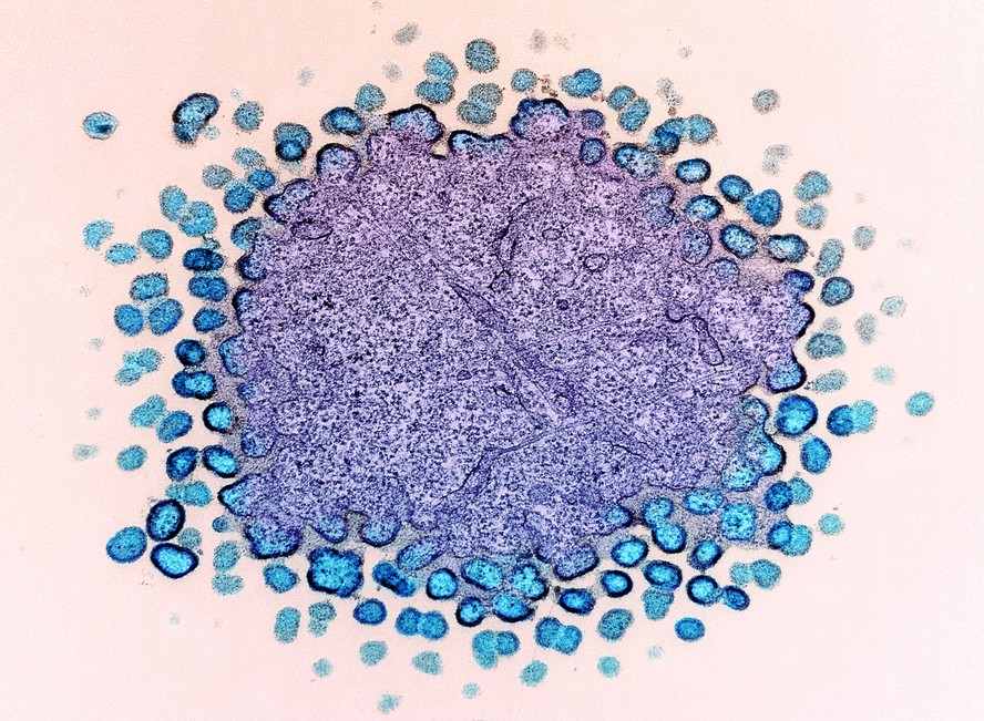 Partículas do HIV (azul claro) se replicando a partir de uma célula infectada (roxo).