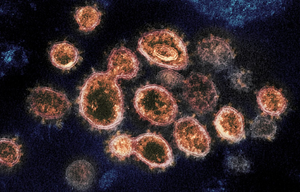 Coronavírus vistos por um microscópio eletrônico.  NIAID/NIH — Foto:         