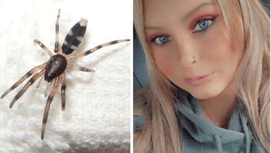 Mulher tem perna amputada após ser picada por aranha 'inofensiva' na Austrália