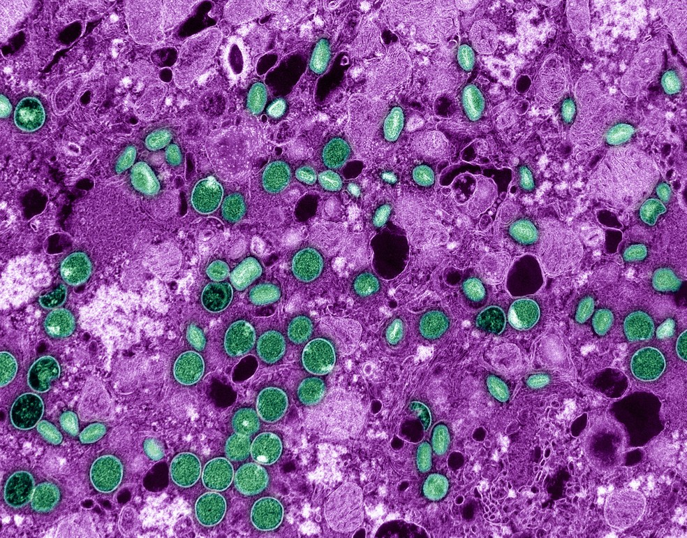 Mpox virus (green) infecting cells (in magenta). — Photo: NIAID