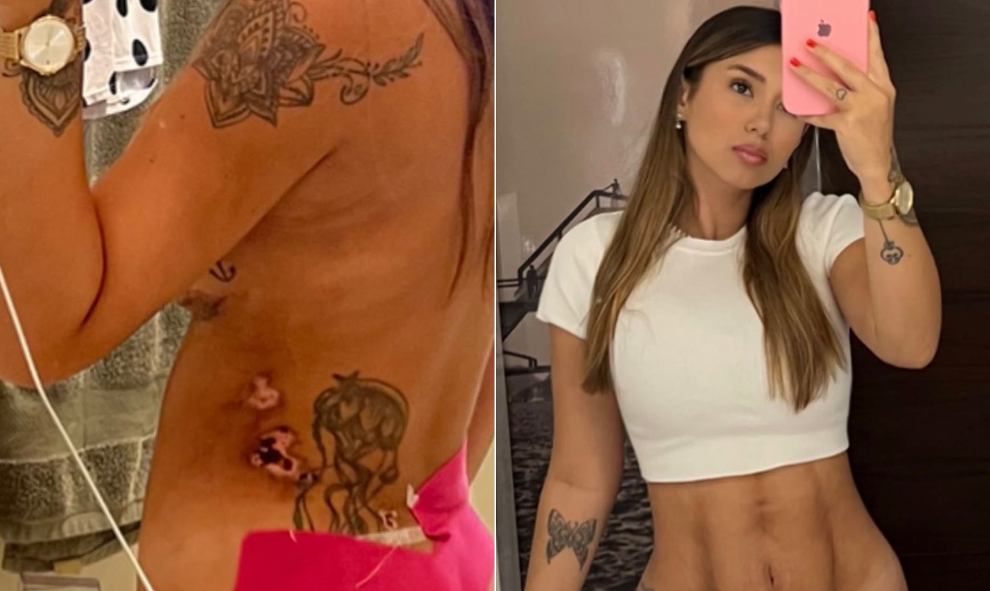 Influenciadora denuncia clínica de estética após complicações graves em cirurgias