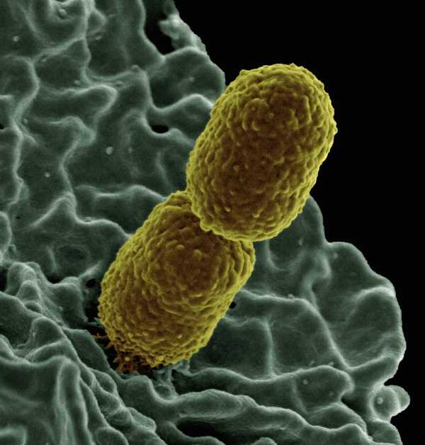 national-institute-of-allergy-