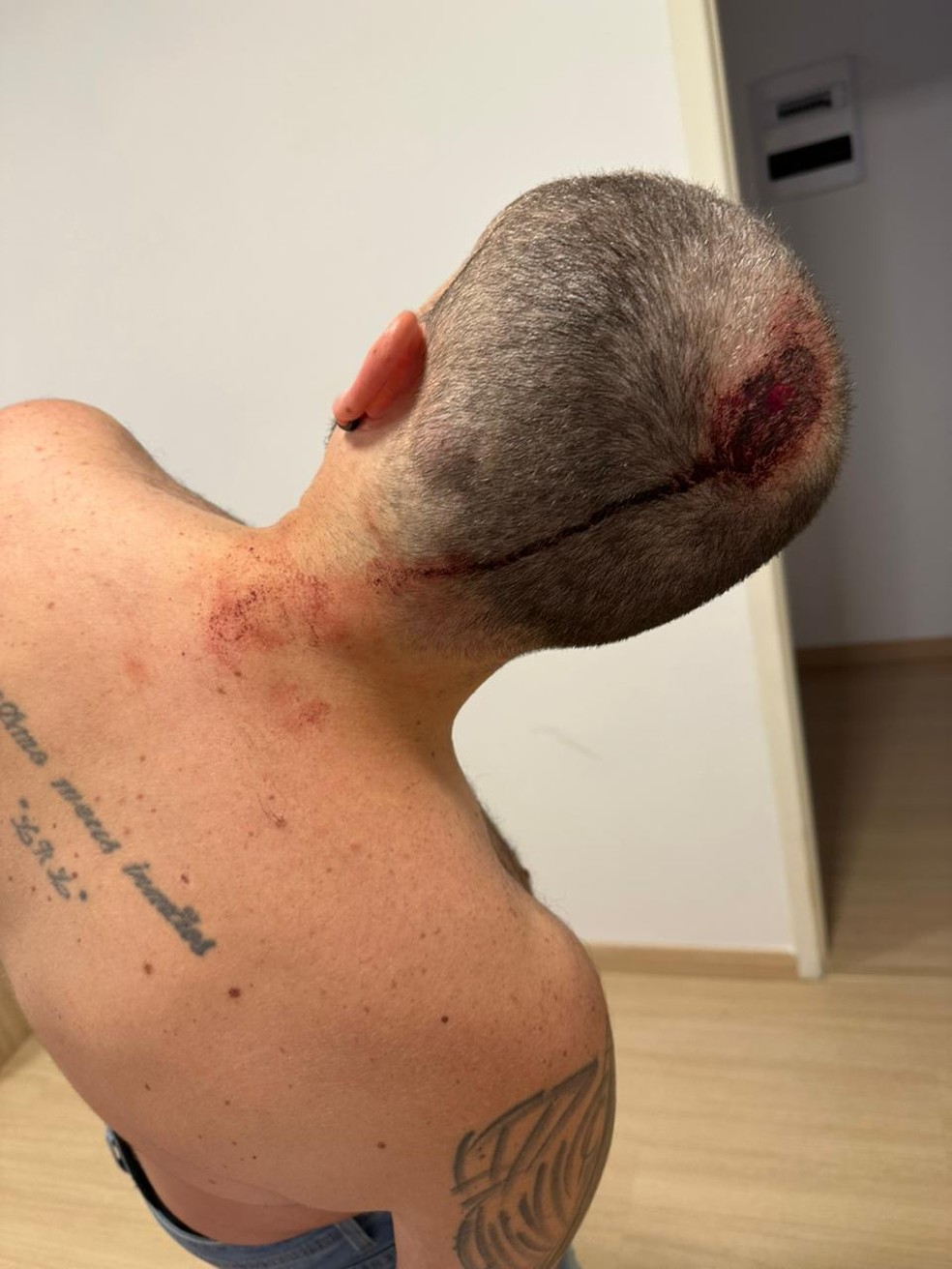 O músico Léo Moreno foi agredido em assalto na Barra com duas coronhadas — Foto: Foto do leitor