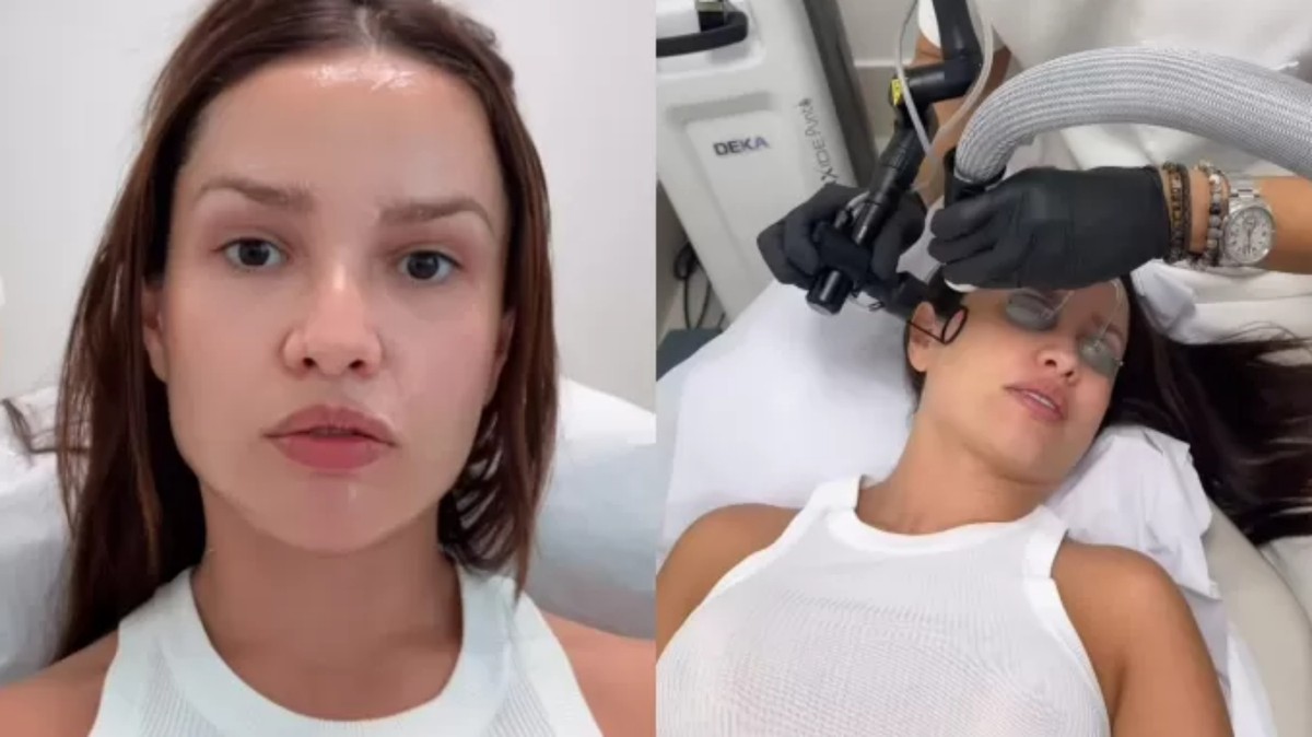O que há por trás do tratamento com DNA de salmão que virou febre entre as celebridades? Veja como funciona