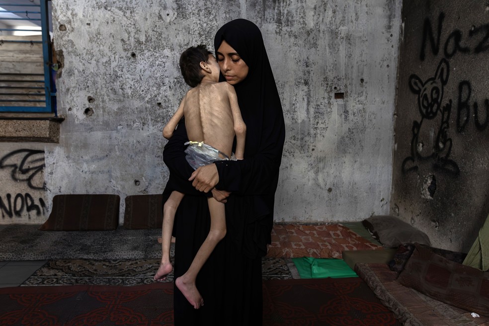 Samah Matar segura seu filho Yousef, de 6 anos, ao norte da Cidade de Gaza, em 24 de julho de 2025; com paralisia cerebral e desnutrição grave, Yousef perdeu cerca de 4 kg desde o início da guerra — Foto: Saher Alghorra / The New York Times
