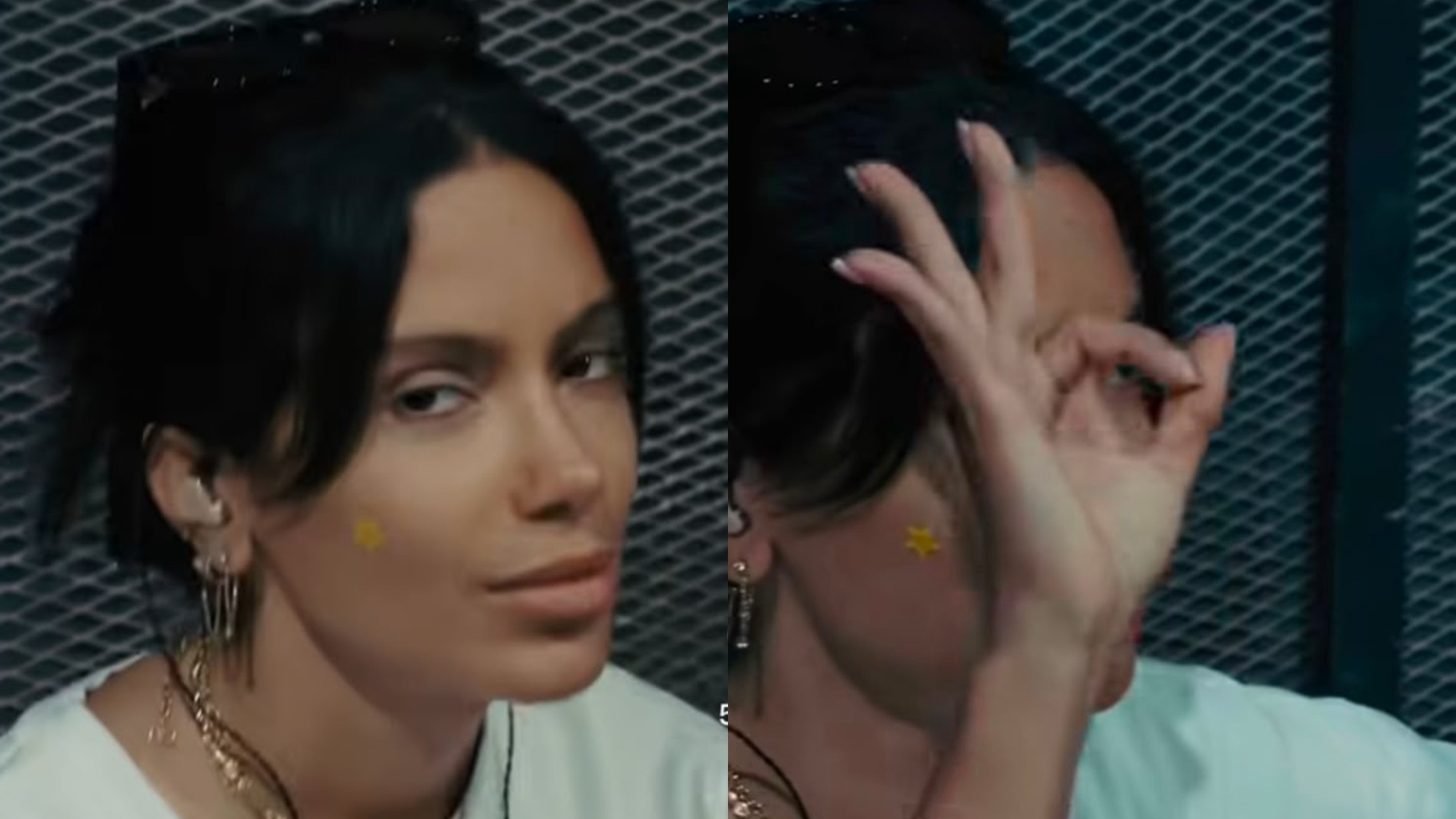 Pimple patch funciona? Entenda quando o adesivo para espinha realmente ajuda - QTU Questões do Universo