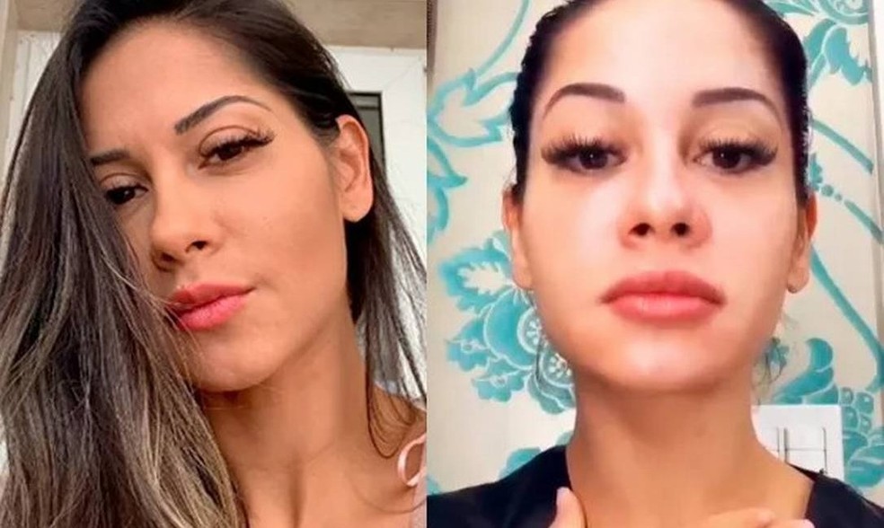 Maira Cardi: antes e depois de preenchimento labial e botox na testa — Foto: Reprodução/Instagram