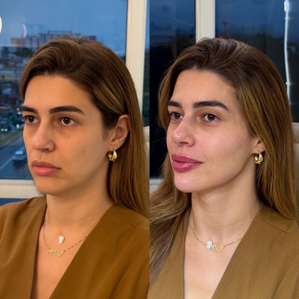 Novo visual de Vivian Amorim ap&oacute;s emagrecimento chama aten&ccedil;&atilde;o nas redes &mdash; Foto: Reprodu&ccedil;&atilde;o Instagram