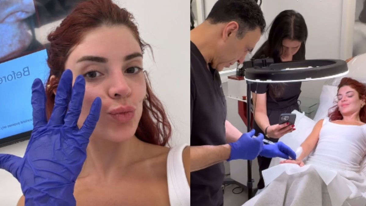 Gkay faz harmonização nas mãos com médico de Kim Kardashian em Los Angeles; confira o resultado