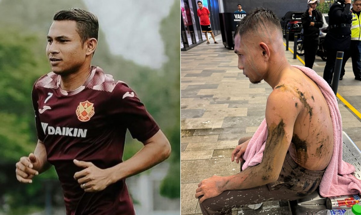jogador-da-sele-o-da-mal-sia-atacado-com-cido-e-passa-por-cirurgia
