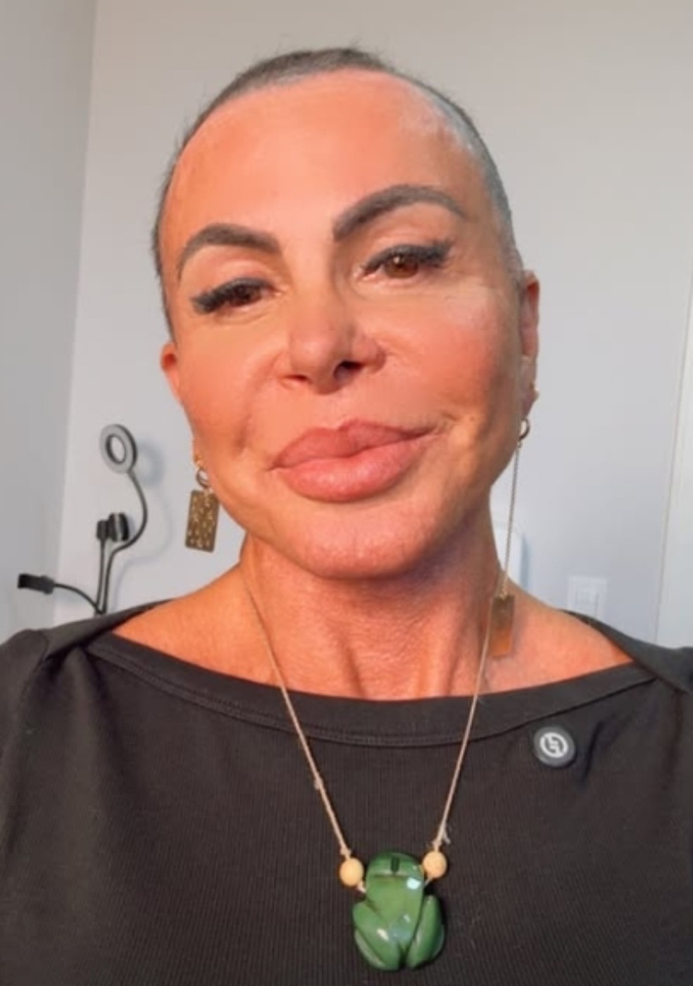 Gretchen faz transplante capilar e revela nova rela&ccedil;&atilde;o com a pr&oacute;pria imagem ap&oacute;s raspar a cabe&ccedil;a &mdash; Foto: Reprodu&ccedil;&atilde;o Instagram