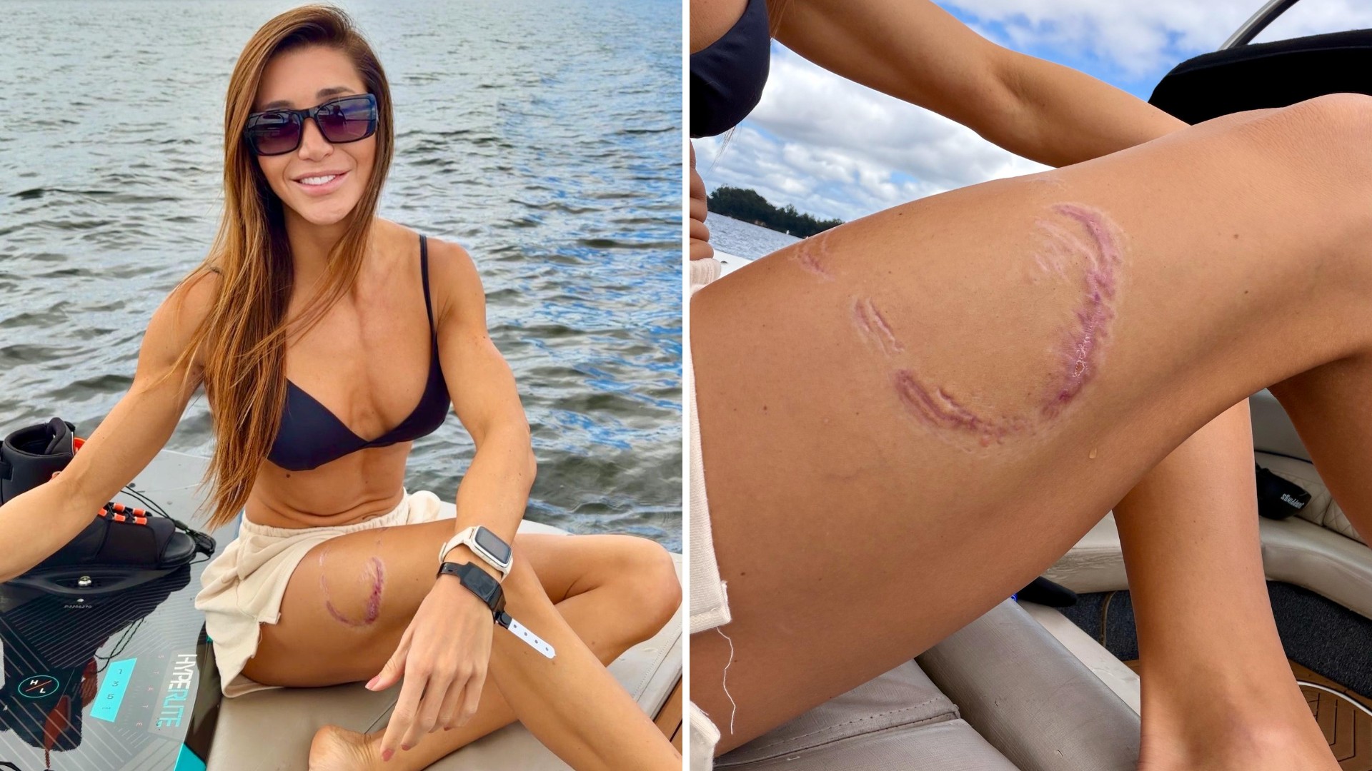 Novo v&iacute;deo mostra momento em que surfista &eacute; mordida por tubar&atilde;o em Fernando de Noronha