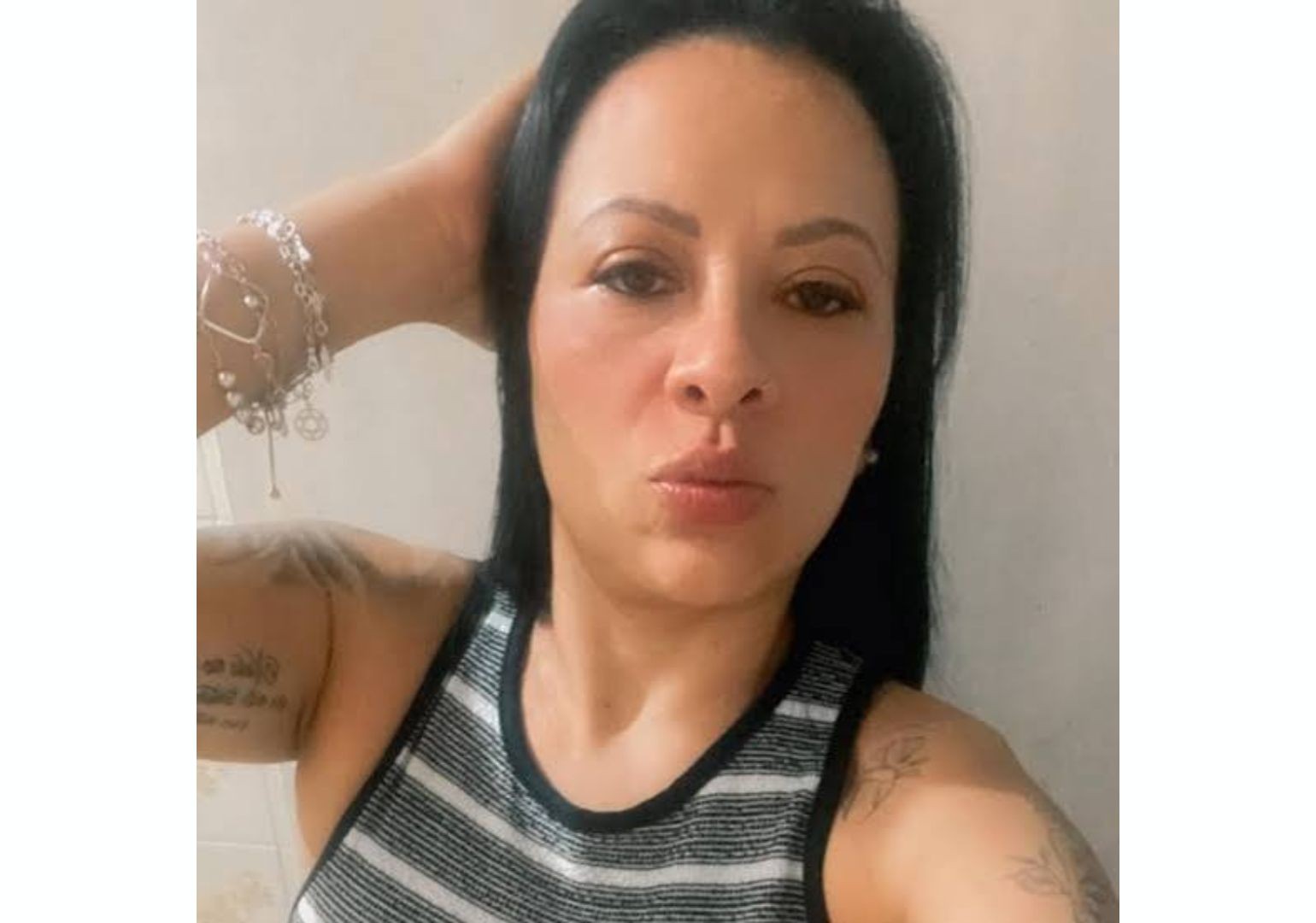 Mulher morre após ter intestino perfurado durante colonoscopia; saiba as complicações mais comuns do exame e como evitá-las - QTU Questões do Universo