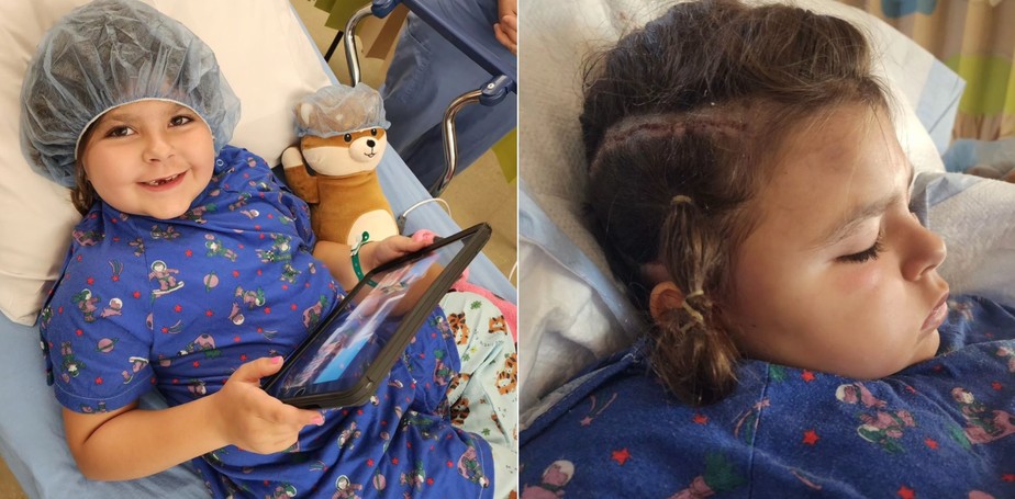 Médicos desconectam metade do cérebro de menina de 6 anos para