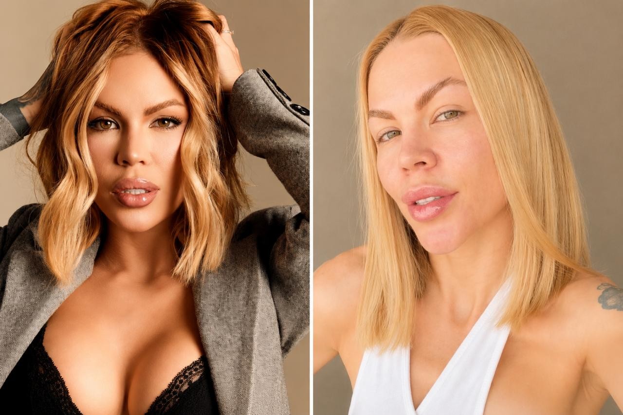 Influenciadora revela ter gastado mais de R$ 100 mil ao fazer reversão estética: 'Meu rosto parecia montado'