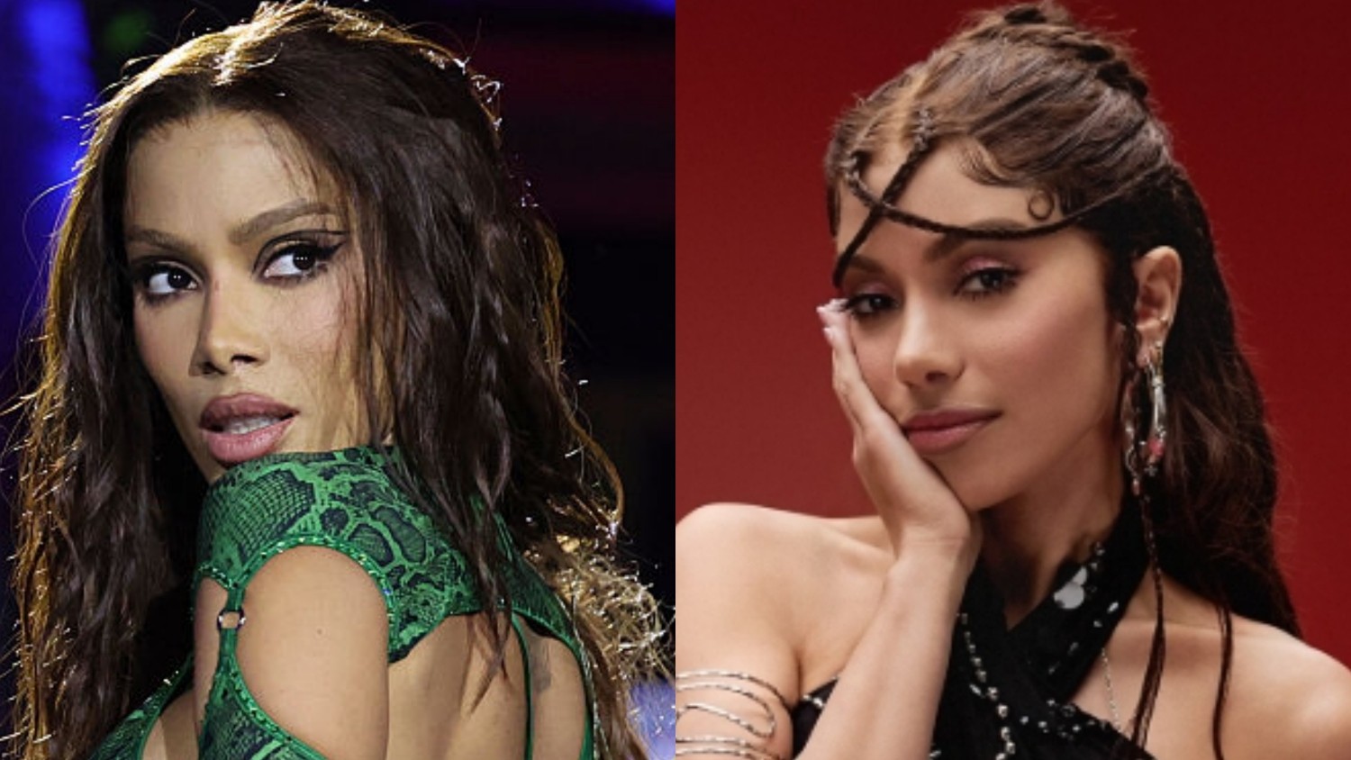 O que mudou no olhar de Anitta? Especialistas apontam possível transplante
