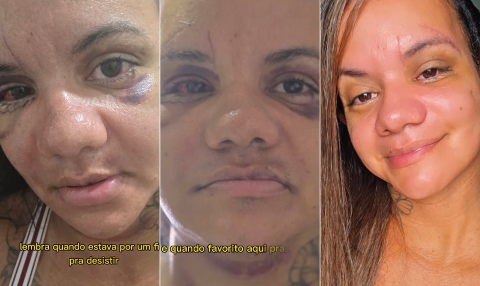 Juliana Garcia dos Santos Soares foi agredida com 61 socos pelo ex — Foto: Reprodução