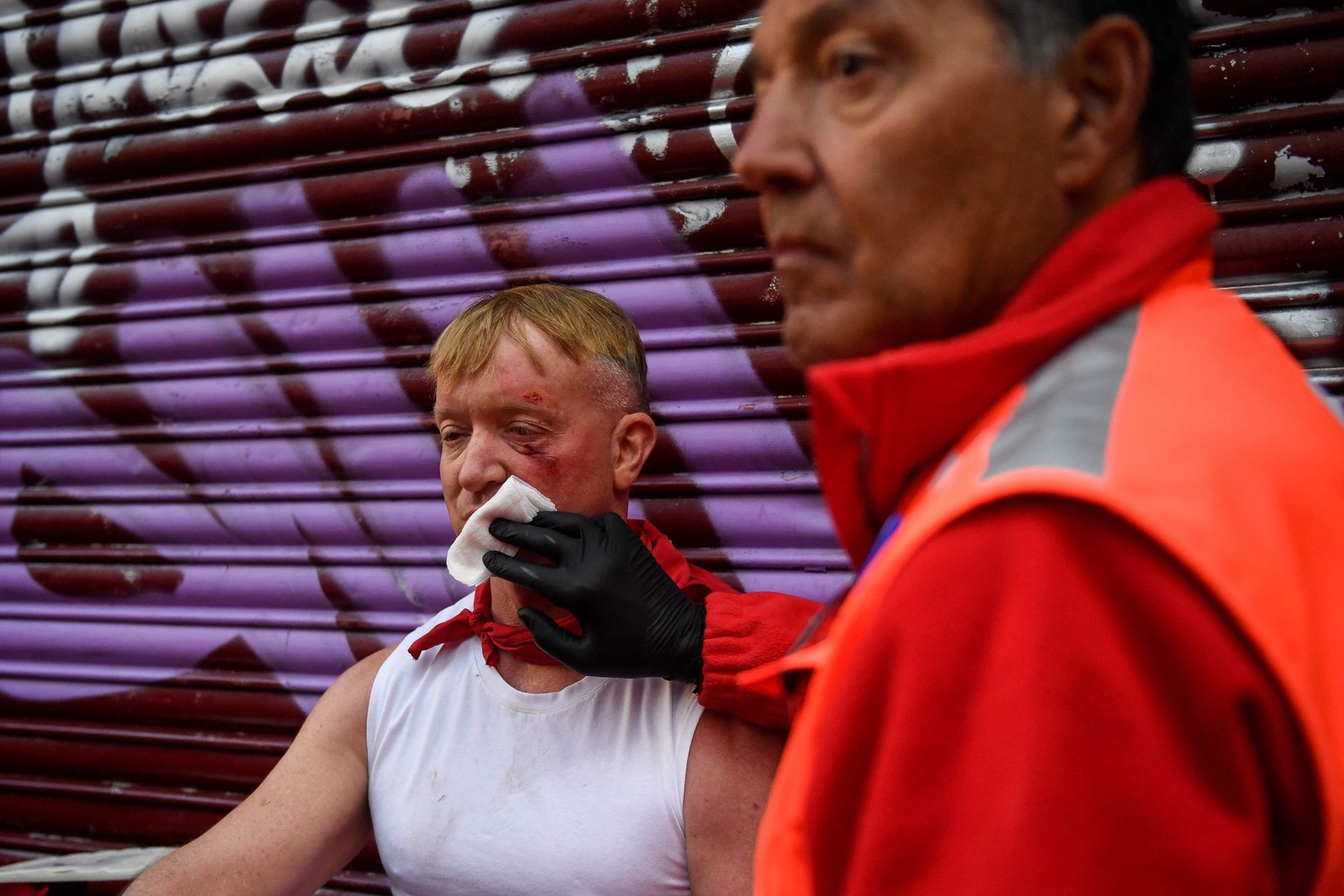 Participante ferido recebe atendimento médico — Foto: Miguel Riopa / AFP