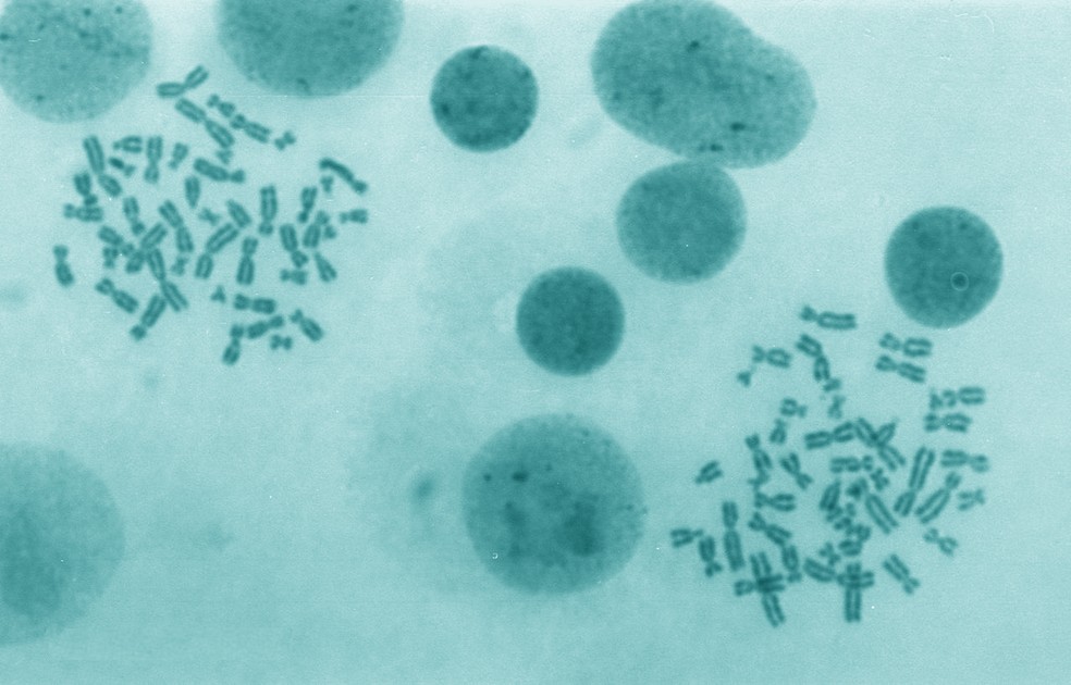 Imagem de microscópio mostra agrupamentos de cromossomos humanos, material biológico que contém o DNA — Foto: Josef Reischig/CC
