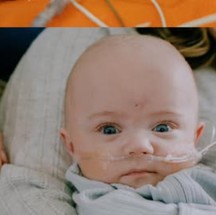 Nash Keen precisou ficar seis meses na UTI — Foto: Instagram