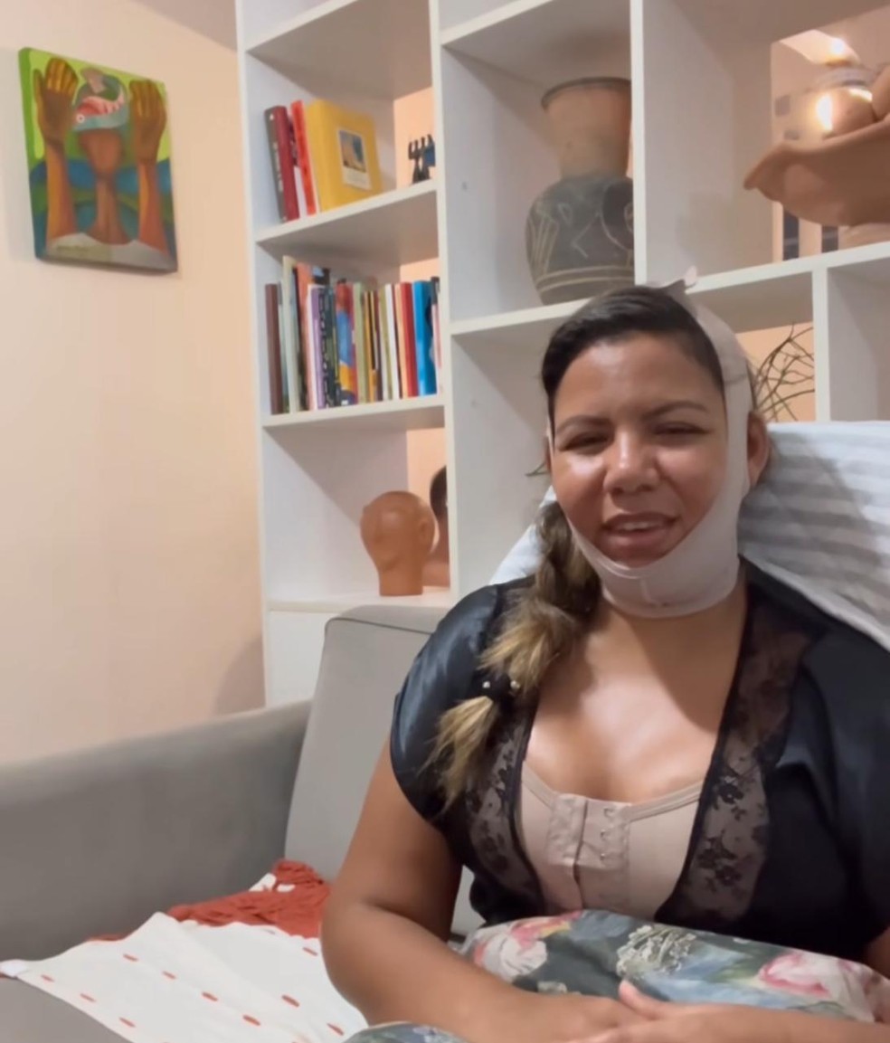 Mani Rego após passar por procedimentos estéticos — Foto: Reprodução/Instagram