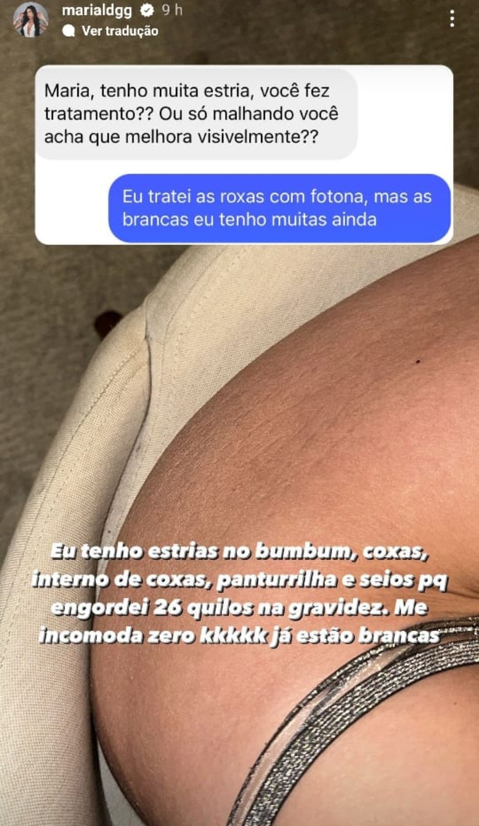 Maria Lina n&atilde;o tem medo de assumir as estrias  &mdash; Foto: Reprodu&ccedil;&atilde;o Instagram