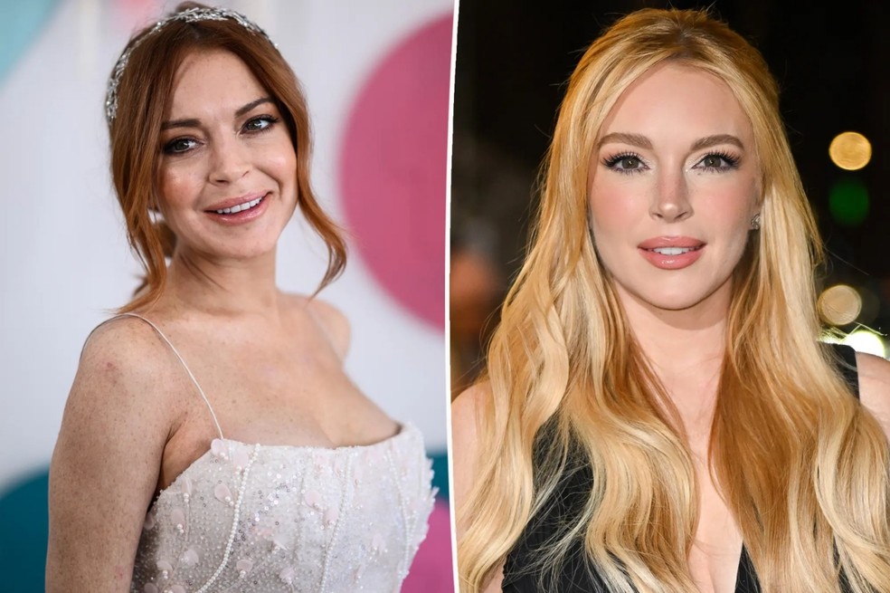 Before and after procedures performed by Lindsay Lohan — Photo: Getty Images