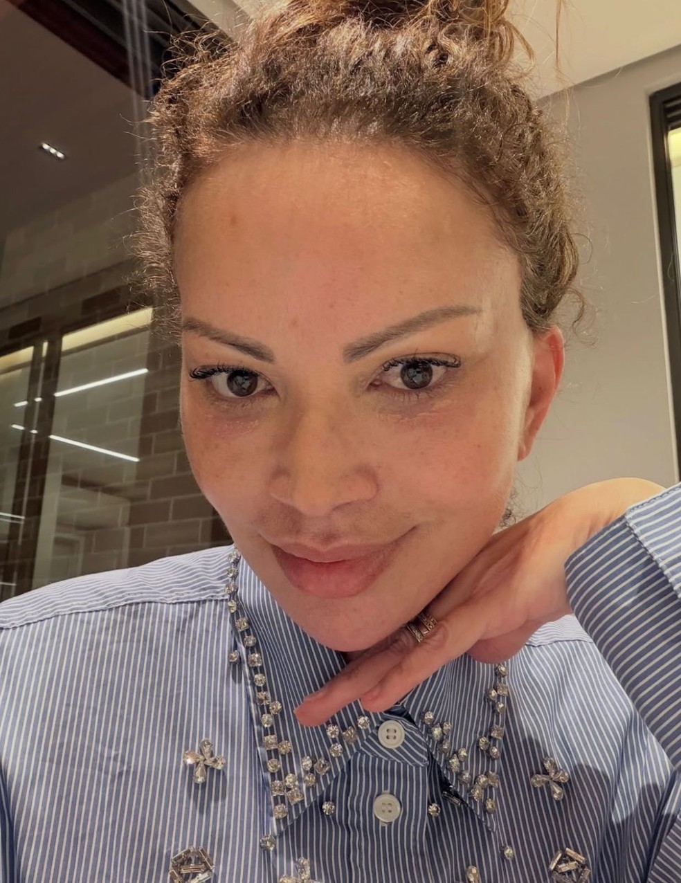 Solange Almeida mostrou rosto após lifting facial e falou sobre autoestima — Foto: Reprodução Instagram