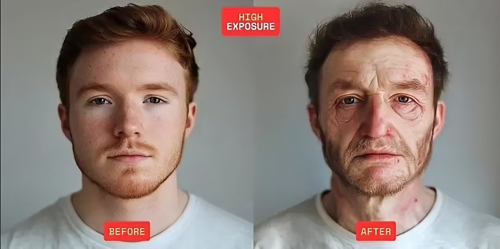 Homem submetido a níveis altos de contaminação por microplásticos — Foto: Reprodução