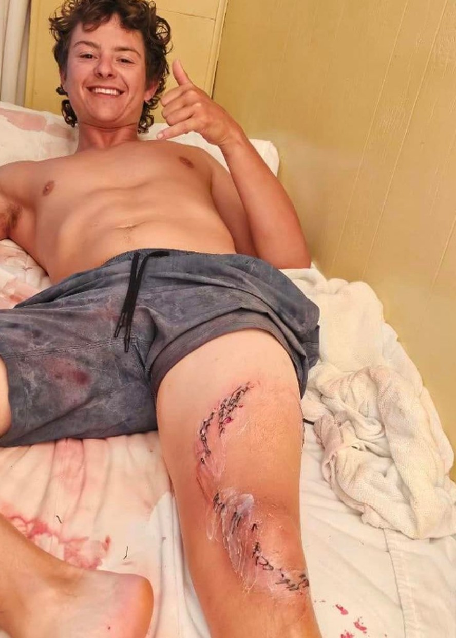 Tive sorte: jovem é mordido após escorregar e cair em marina infestada de  tubarões, nas Bahamas