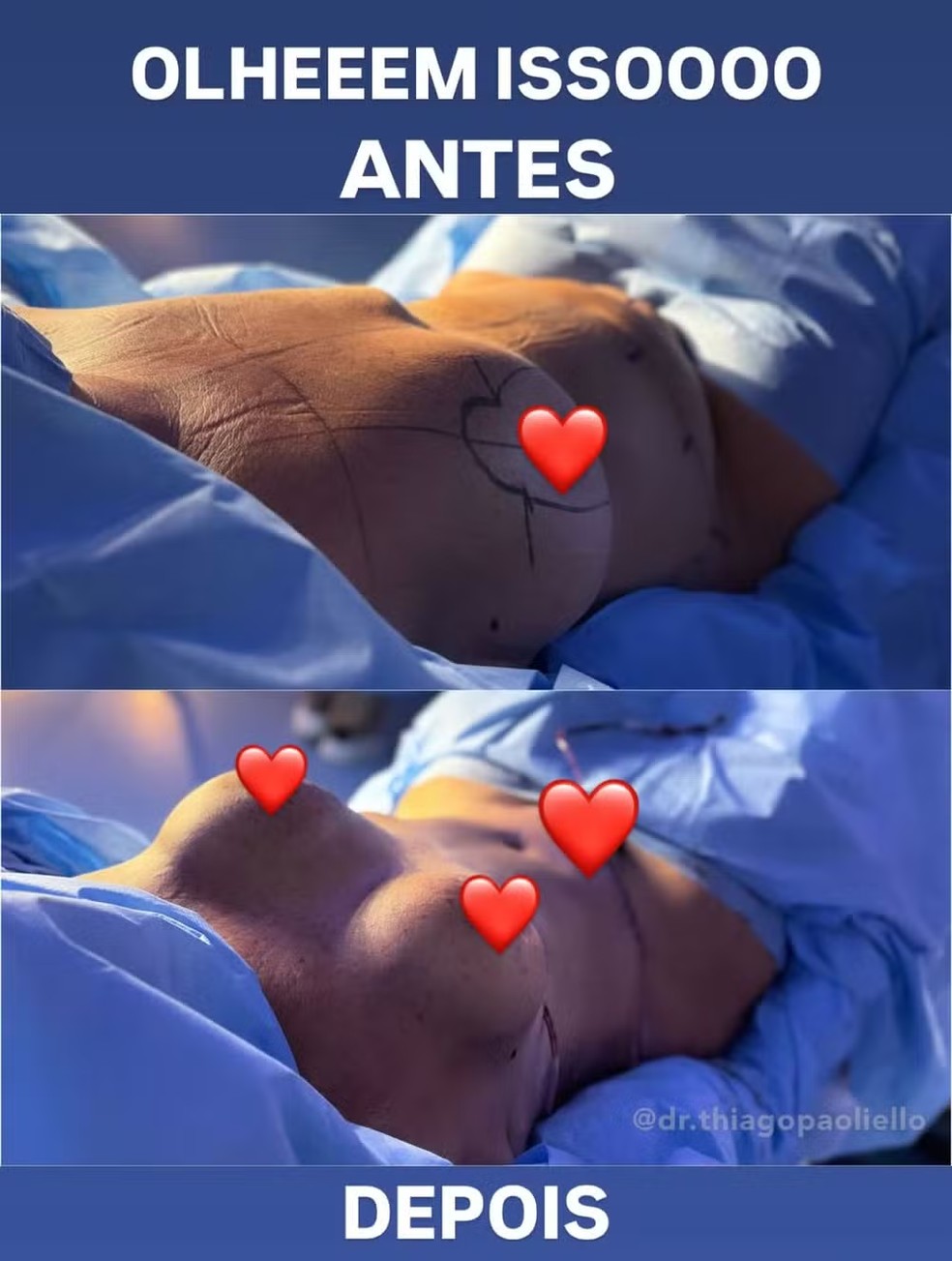 M&atilde;e de Virg&iacute;nia Fonseca, Margareth Serr&atilde;o passou por abdominoplastia e colocou silicone &mdash; Foto: Reprodu&ccedil;&atilde;o Instagram