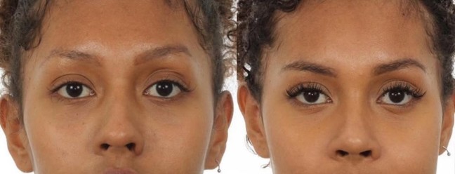 Giovanna Jacobina passou por uma cirurgia ortognática e rinoplastia — Foto: Reprodução/Instagram | Dra. Katyuscia
