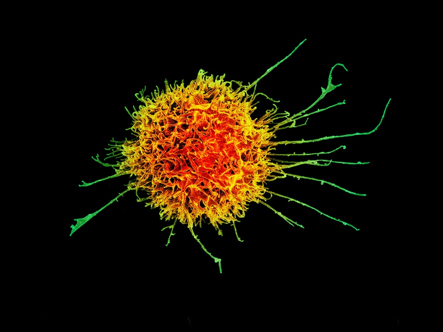 Células NK, parte importante do sistema imunológico.