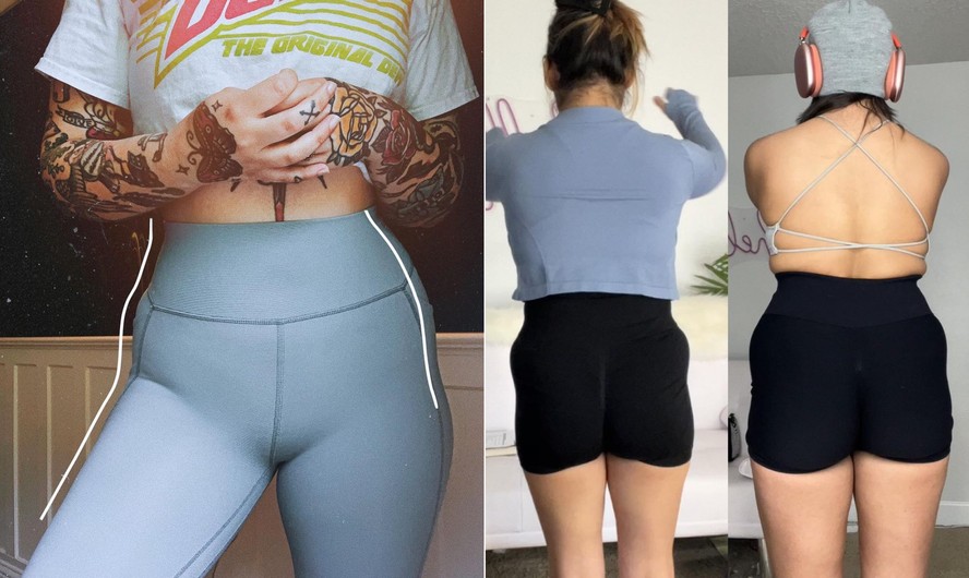 'Hip dips': especialista fala sobre 'depressão visível' nos glúteos ...