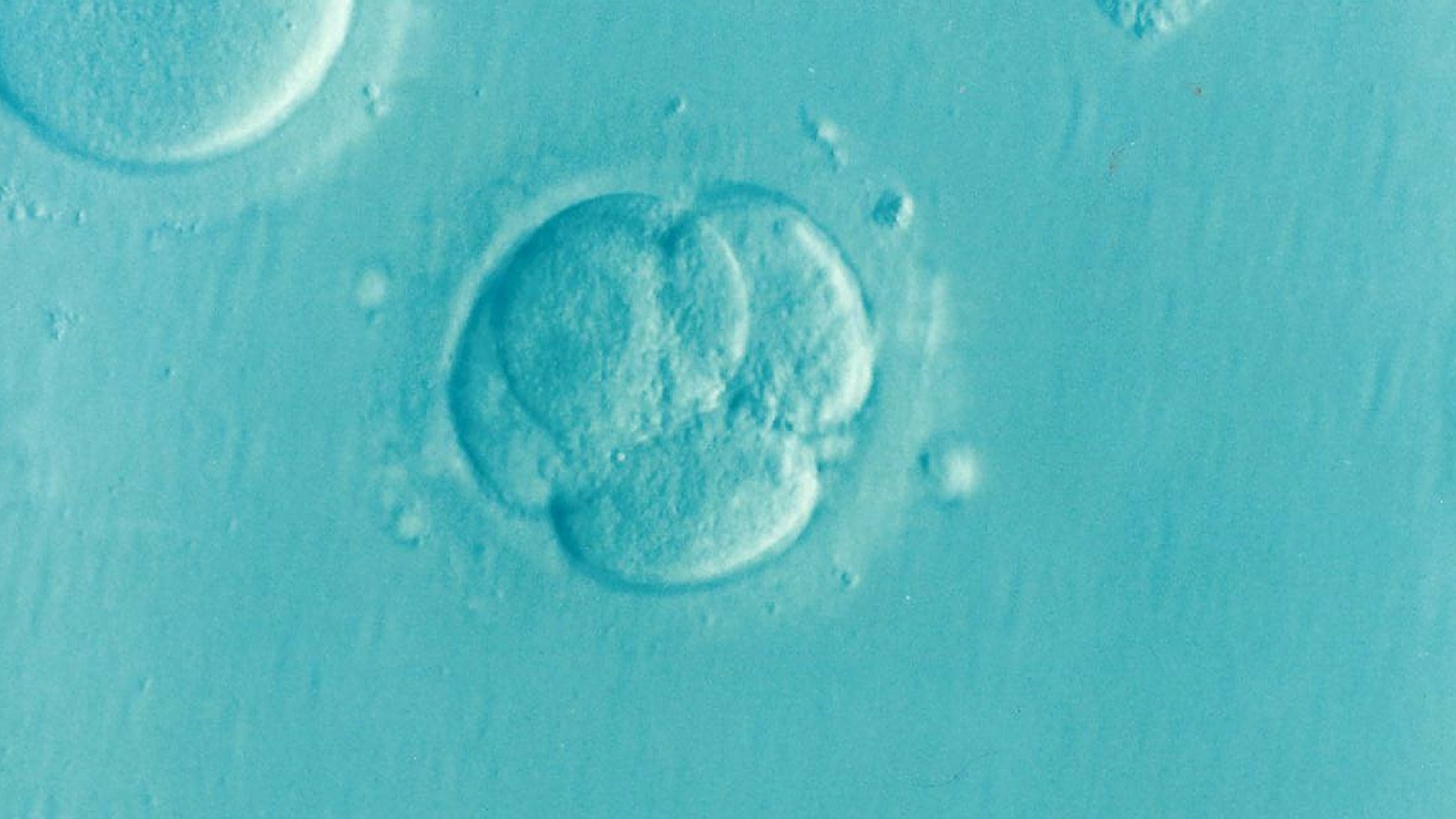 Testes genéticos em embriões podem ajudar mulheres acima de 35 anos a conceber mais rápido