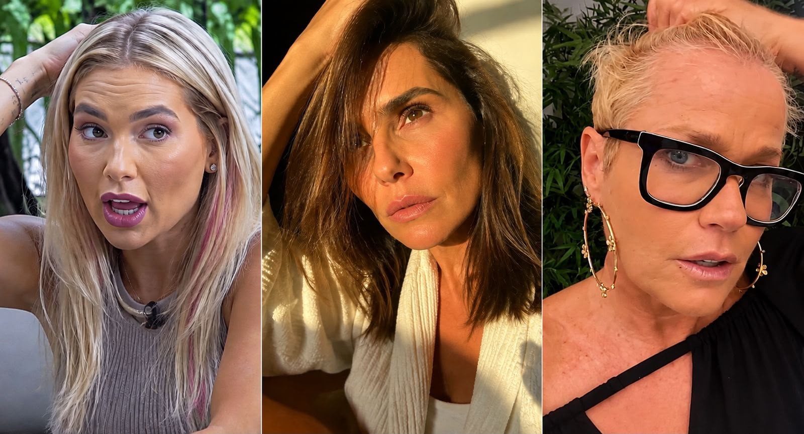 Falhas ou fios mais finos? Médica explica como os tipos de alopecia se manifestam - Foto