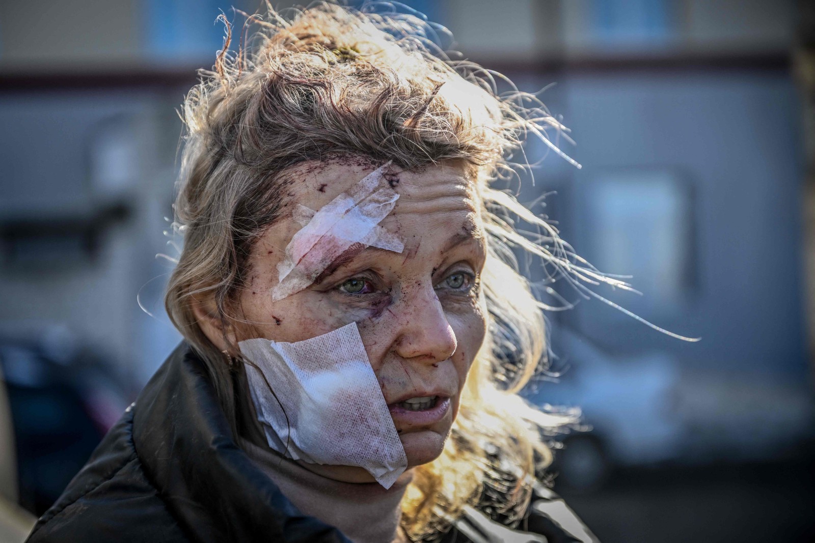 O semblante Olena Kurylo, uma professora de 52 anos, ferida em um bombardeio, refletia o sentimento de um país — Foto: Aris Messinis/AFP/24-02-2022