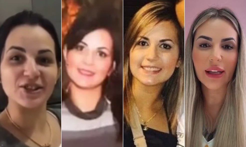 Deolane Bezerra: antes e depois da advogada e influenciadora digital mostram como transforma��es no rosto por meio de cirurgias pl�sticas � Foto: Reprodu��o/Instagram e Divulga��o