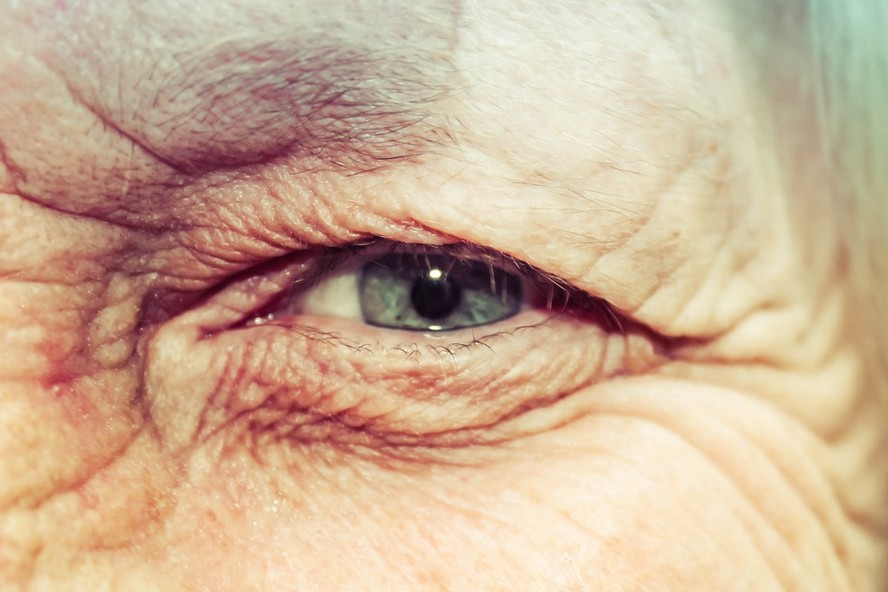 Inflamações Oculares: conheça os 3 tipos mais comuns